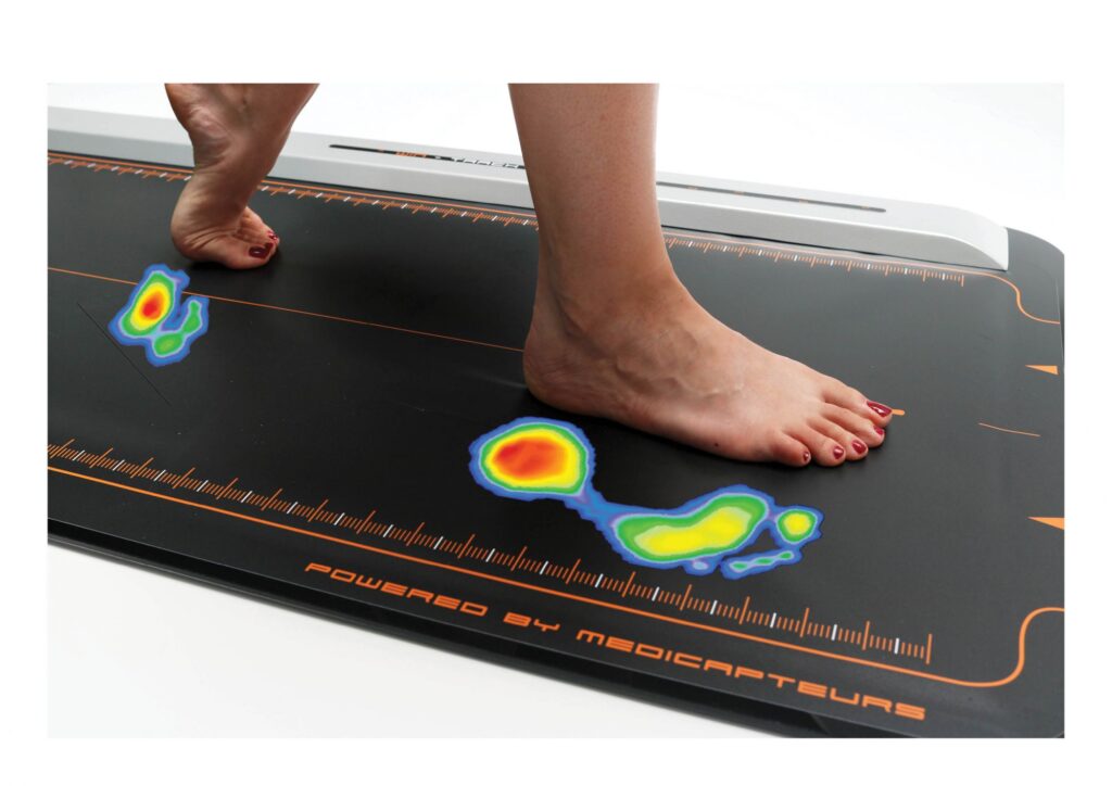 foot scanning